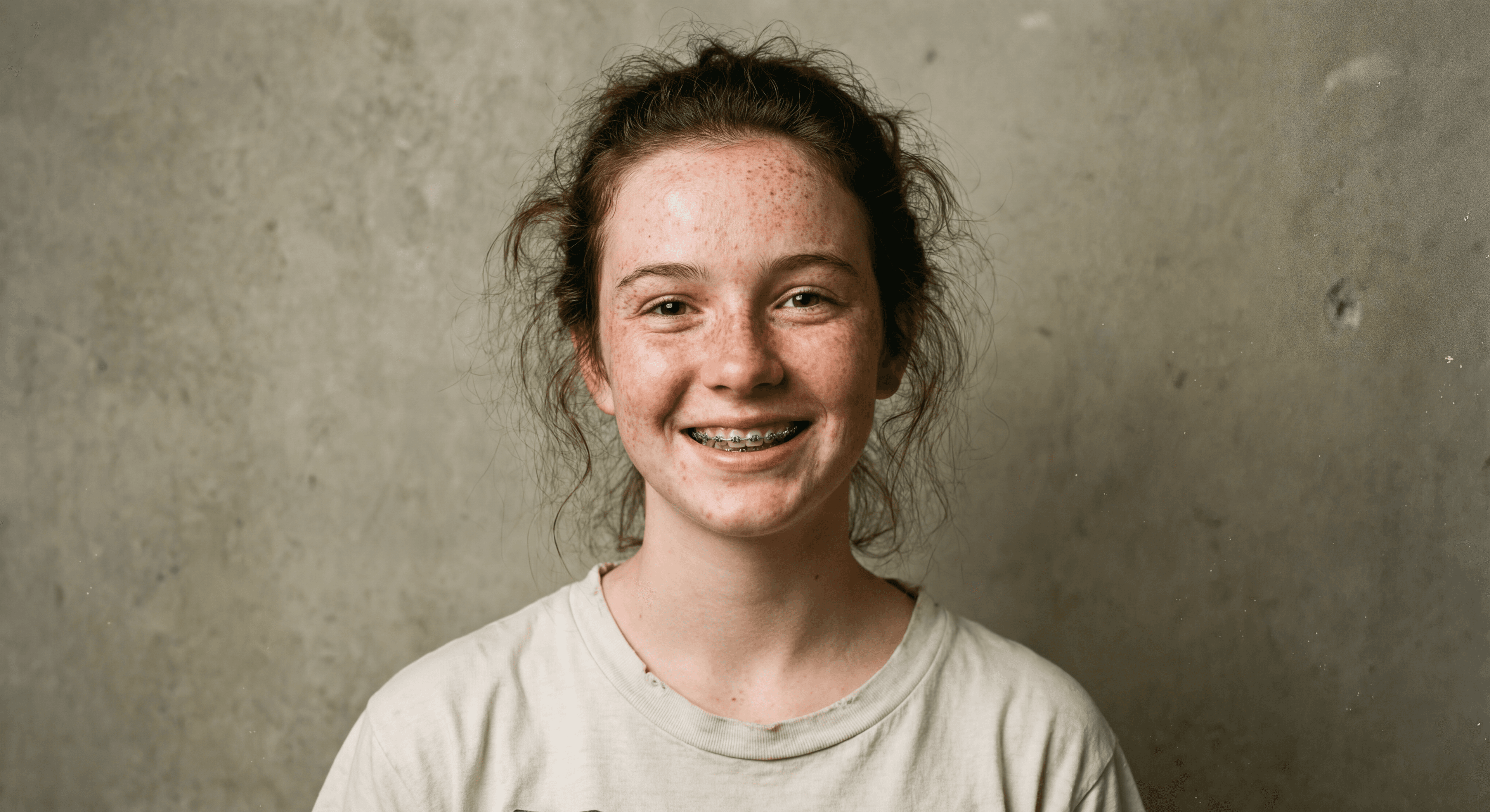 Портрет с прыщами