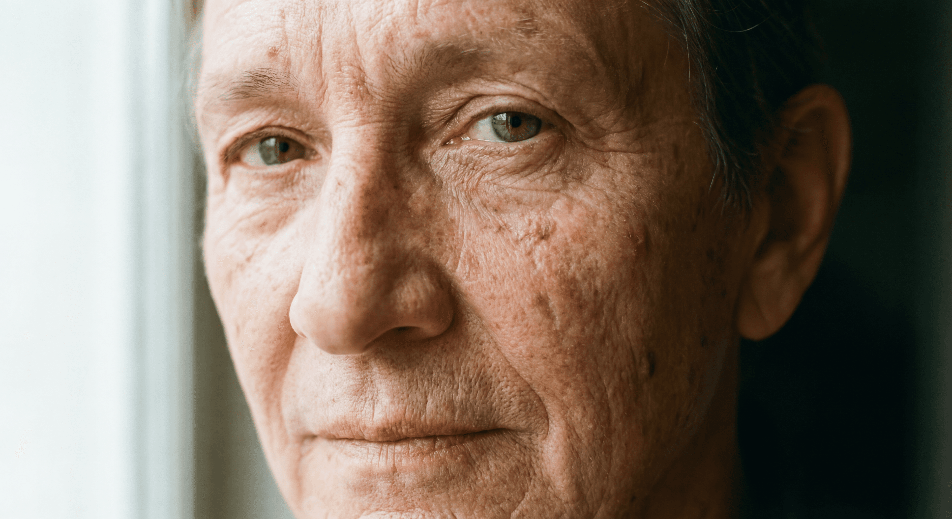 Портрет с прыщами